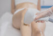 Epilare Cu Laser Brasov